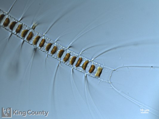 Photo of Chaetoceros vanheurckii